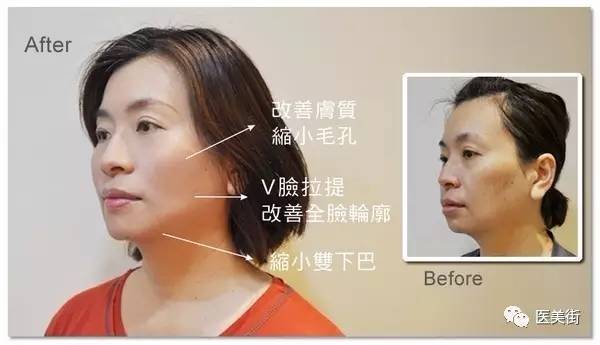 线雕最新手法，与自然美景共塑美丽轮廓的亲密旅行